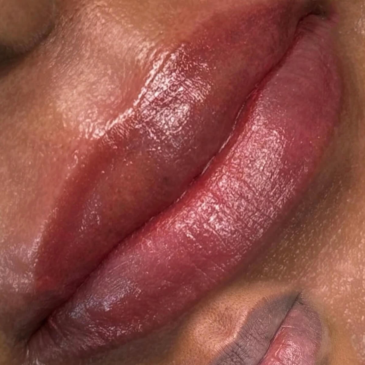 Lip Neutralization
A specialized treatment designed to soften dark pigmentation and create a brighter, more balanced lip appearance.
Learn More →